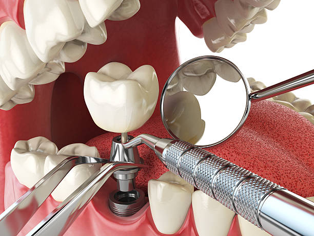 Dentist for Dental Trauma in CO